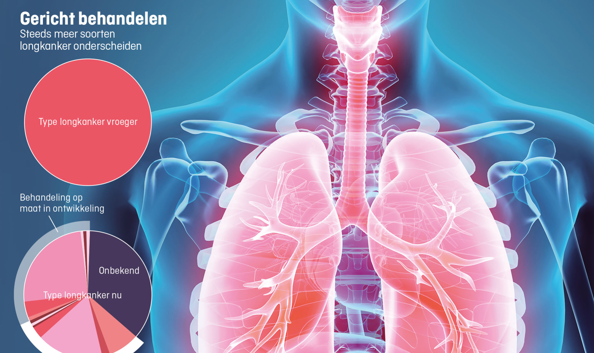 Dé longkanker bestaat niet meer EWmagazine